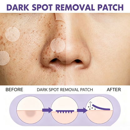 Stop Stubborn Breakouts & Fade Acne Marks | Lumivz Hydrocolloid Acne Patches